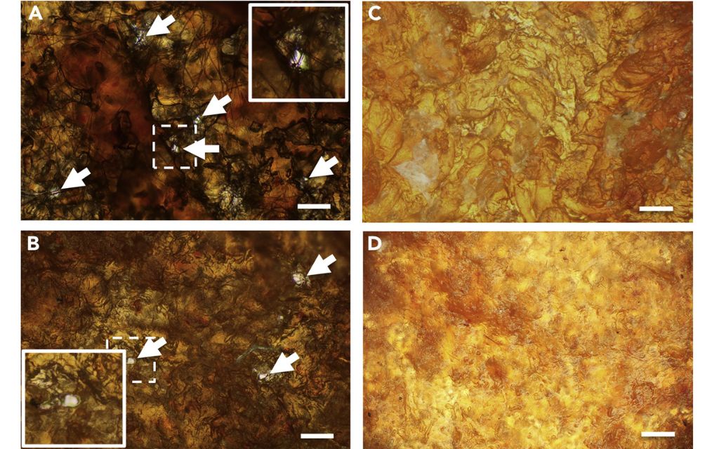 obraz mikroskopowy wieczka czerwiu
