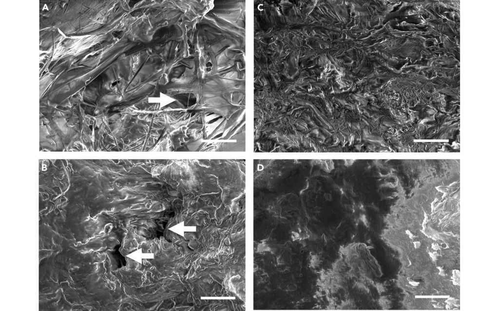 obraz z mikroskopu elektronowego wieczek