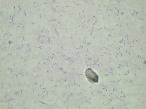 Choroby bakteryjne czerwia i pszczół