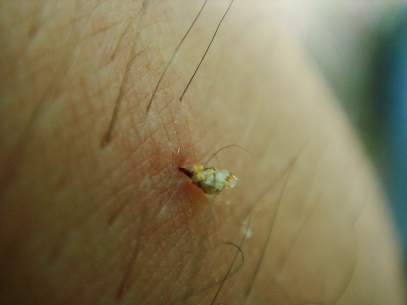 Przepisy prawa karnego i kodeksu wykroczeń służące ochronie gospodarki pasiecznej