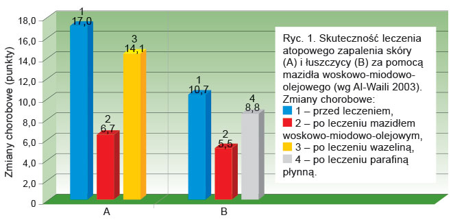 Ryc. 1. Skuteczność leczenia atopowego zapalenia skóry (A) i&nbsp;łuszczycy (B) za pomocą mazidła woskowo-miodowo-olejowego (wg Al-Waili 2003).