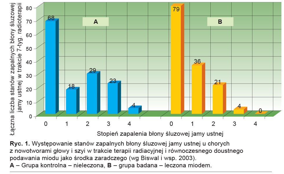 Występowanie stanów zapalnych błony śluzowej jamy ustnej u chorych z nowotworami głowy i szyi w trakcie terapii radiacyjnej i równoczesnego doustnego podawania miodu jako środka zaradczego (wg Biswal i wsp. 2003).
