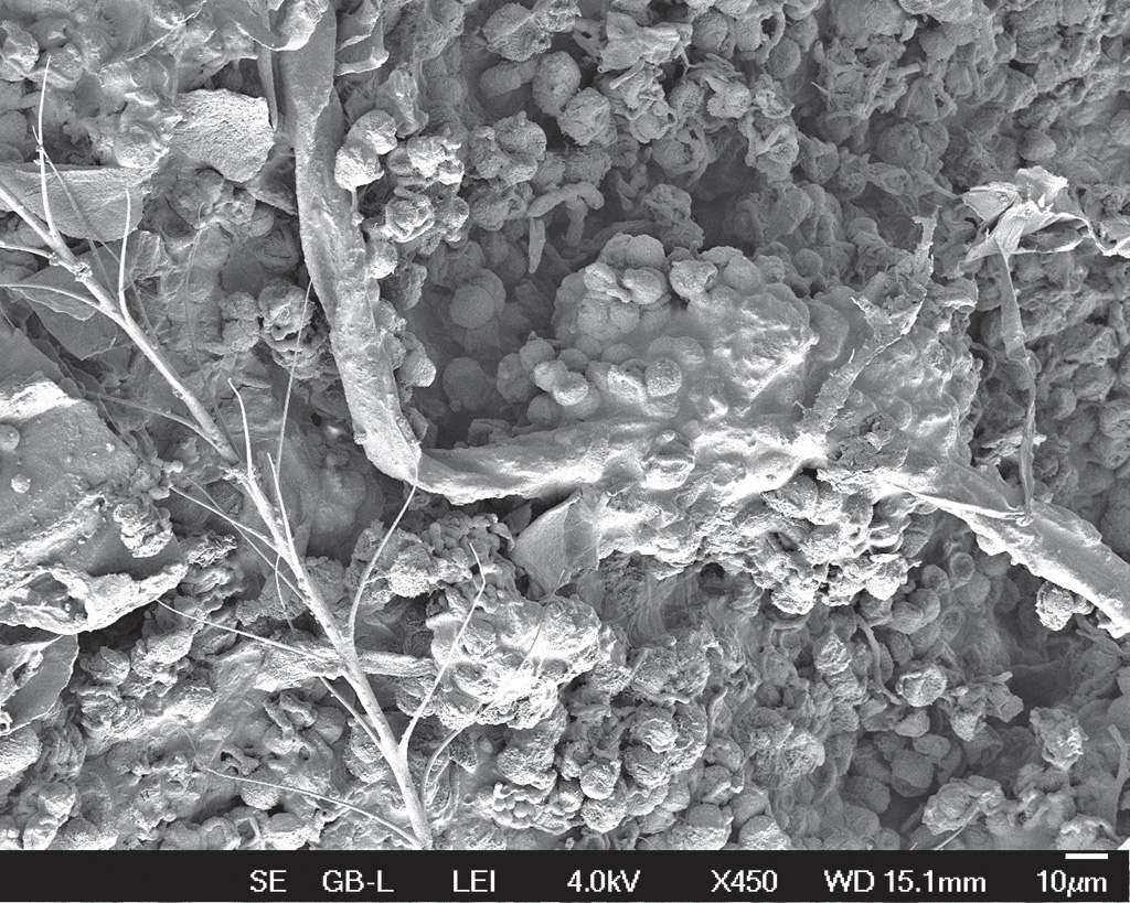 Pasieka nr 95 ([PAS95], maj - czerwiec 2019, fot_4b_Rouskovani zelene rasy zrnenky_5)