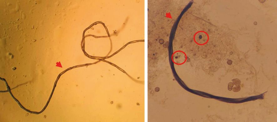 Fot. 2. Zdjęcia przedstawiające mikroplastik obecny w badanych próbkach miodu. Strzałkami zaznaczono mikroplastik w postaci włókien, a okręgami w postaci kulek.
